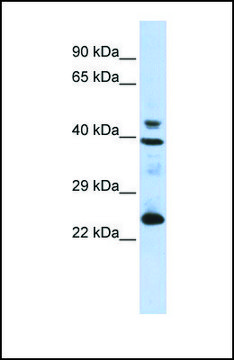Anti-SEPP1, (N-terminal) antibody produced in