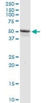 Anti-ACP6 antibody produced in rabbit