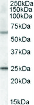 Anti-COL4A3BP (AA 662-672) antibody produced