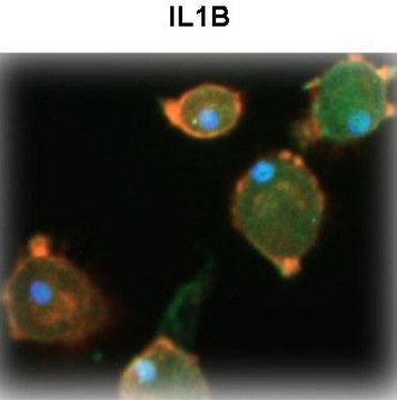 Anti-IL1B (N-terminal) antibody produced in