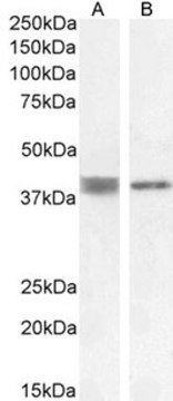 Anti-ATP6IP2/Renin Receptor antibody produced in