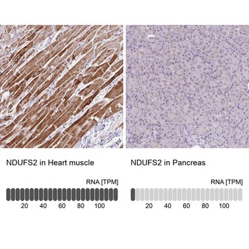 Anti-NDUFS2 antibody produced in rabbit