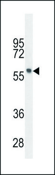 ANTI-FEZF1 (N-TERM) antibody produced in