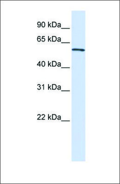 Anti-ALAS2 (ab3) antibody produced in