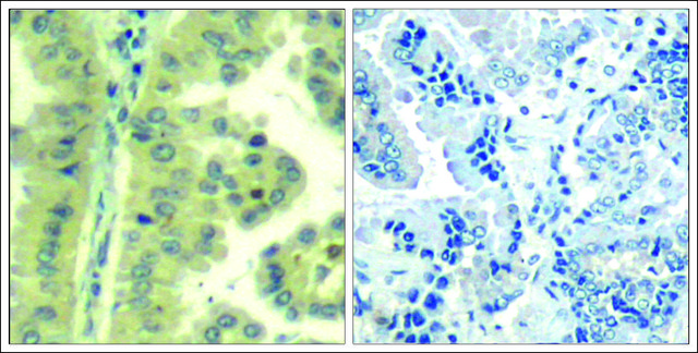 Anti-EIF4G1 (Ab-1232) antibody produced in