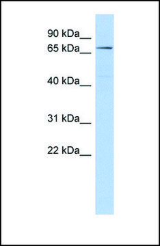 Anti-CLPB antibody produced in rabbit