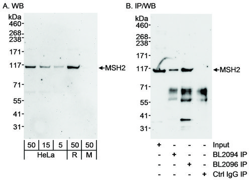Rabbit anti-MSH2 Antibody, Affinity Purified