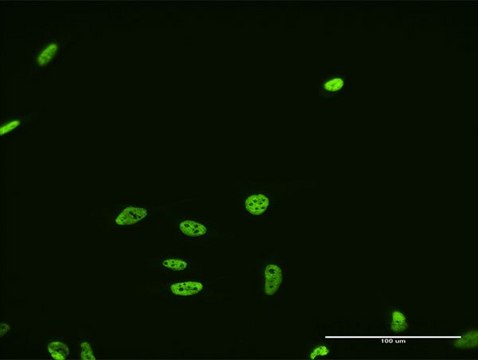 Monoclonal Anti-FUSIP1, (N-terminal) antibody produced