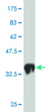 Monoclonal Anti-LMO1, (N-terminal) antibody produced