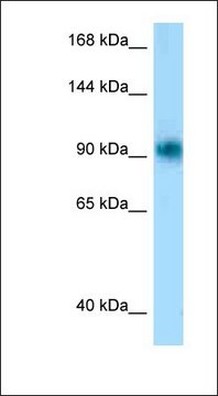 Anti-PRKD1 antibody produced in rabbit
