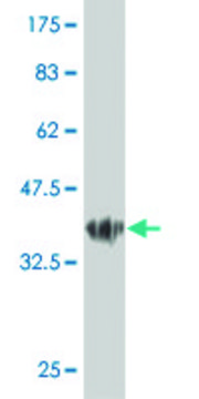 ANTI-GUCY2C antibody produced in mouse