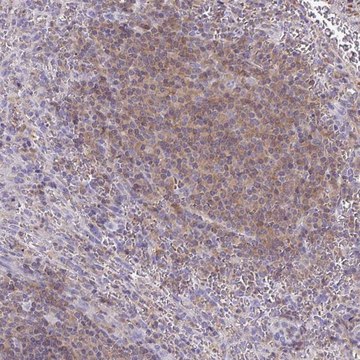 Anti-TNFAIP8 antibody produced in rabbit