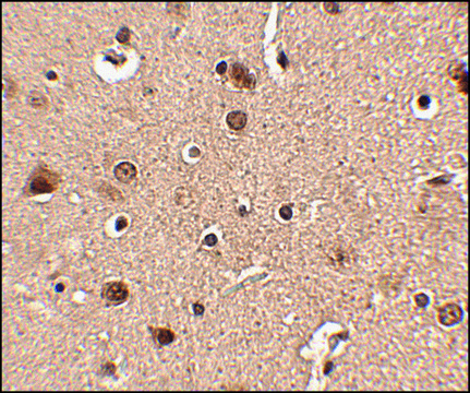 Anti-Slitrk4 antibody produced in rabbit