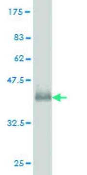 ANTI-GUCY2D antibody produced in mouse