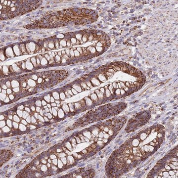 Anti-VPS16 antibody produced in rabbit