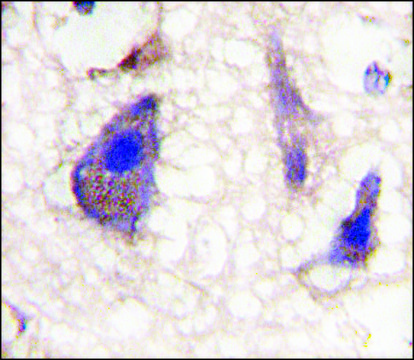 Anti-NP1(Nptx1) (C-term) antibody produced in