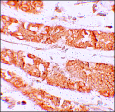 Anti-HMMR antibody produced in rabbit
