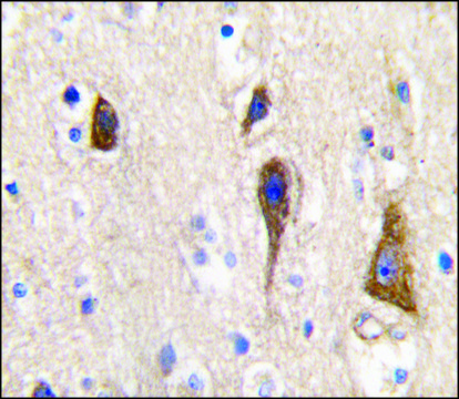 Anti-CYP2R1 (center) antibody produced in