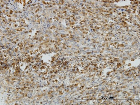 Monoclonal Anti-IL31RA antibody produced in