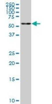 Monoclonal Anti-FAAH, (C-terminal) antibody produced
