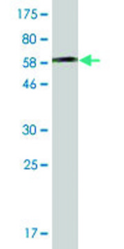 ANTI-AHCY antibody produced in mouse