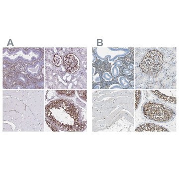 Anti-AKAP12 antibody produced in rabbit