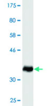 Monoclonal Anti-SMCP antibody produced in
