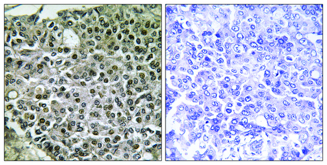 Anti-NFAT3 antibody produced in rabbit