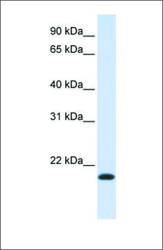 Anti-NKAIN1 antibody produced in rabbit