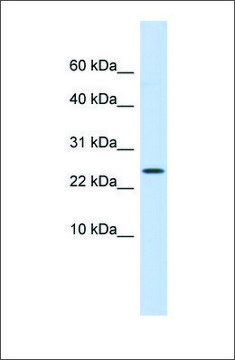 Anti-LYPD6 antibody produced in rabbit