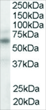 Anti-LXR ?/LXR ? antibody produced