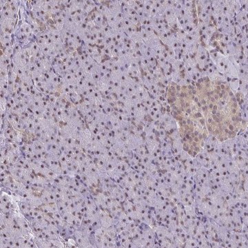 Anti-ING4 antibody produced in rabbit