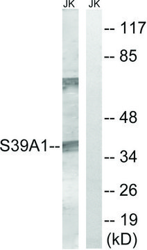 Anti-SLC39A1 antibody produced in rabbit
