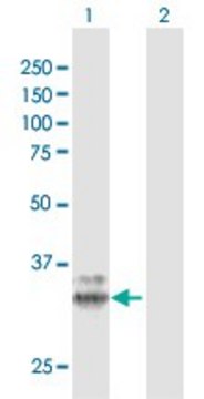 Anti-PPT1 antibody produced in rabbit