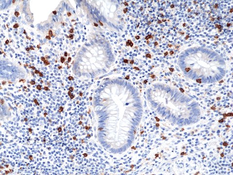 Anti-CD8a Rabbit Monoclonal Antibody