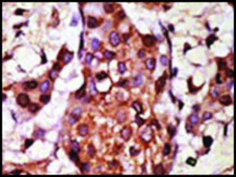 Anti-ZMYM2 (C-term) antibody produced in