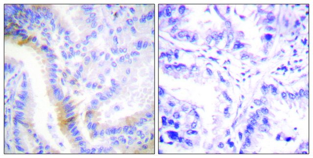 Anti-Urocortin antibody produced in rabbit
