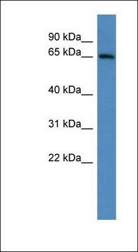 Anti-ADAM23 antibody produced in rabbit