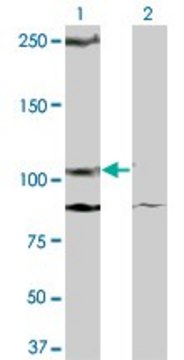 ANTI-KIT antibody produced in mouse