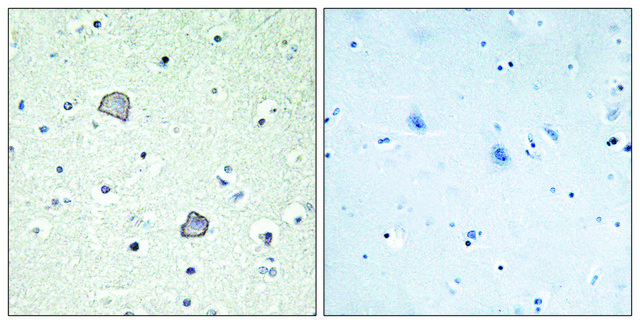Anti-EDG2 antibody produced in rabbit