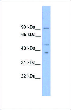 Anti-ZFX, (N-terminal) antibody produced in