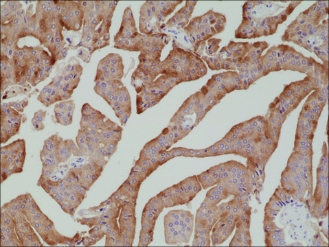 Anti-PSA (Prostate Specific Antigen) antibody,