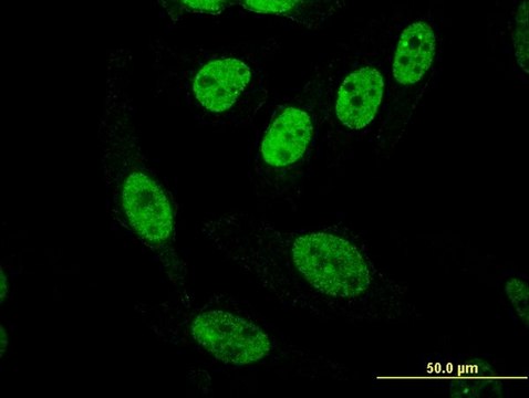 ANTI-PASD1 antibody produced in mouse