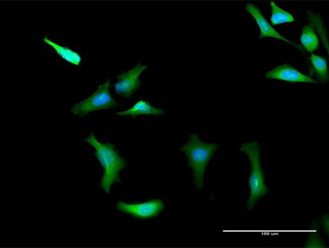 Anti-PRKAG2 antibody produced in rabbit
