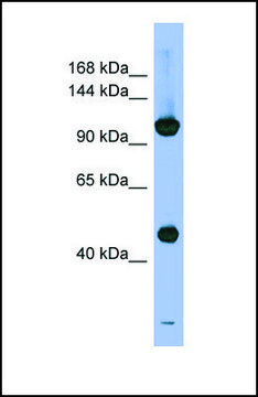 Anti-PSMD1, (N-terminal) antibody produced in