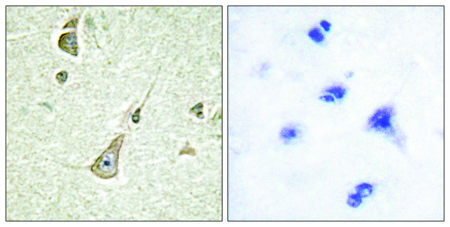 Anti-PCDH-X antibody produced in rabbit