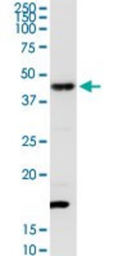 Anti-TXNDC4 antibody produced in rabbit