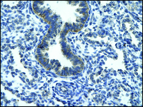 Anti-RGS19 antibody produced in rabbit