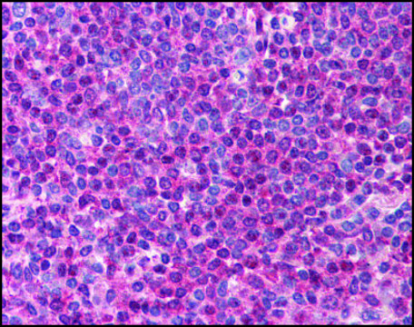 Anti-TIRAP (AB2) antibody produced in