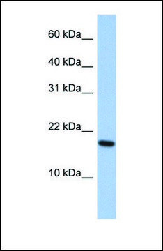 Anti-ARL5A antibody produced in rabbit